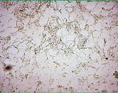 Soi tươi KOH tìm đẹn