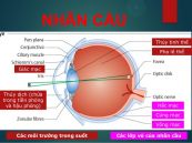 Tật không nhãn cầu và mắt nhỏ