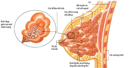 Thay đổi sợi bọc tuyến vú