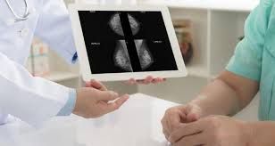 Vôi hóa tuyến vú