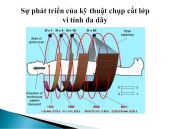 Chụp cắt lớp vi tính (angiograms CT) mạch vành