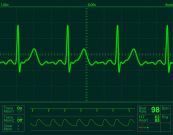 Cử động run cơ tạo hình ảnh điện tâm đồ