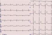 Điện tâm đồ (ECG hoặc EKG)