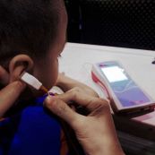 Đo nhĩ lượng: ý nghĩa lâm sàng kết quả thủ thuật