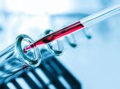 Glucose máu: ý nghĩa lâm sàng chỉ số xét nghiệm