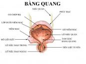 Kiểm tra áp lực bàng quang và Bonney cho chứng tiểu không tự chủ ở phụ nữ