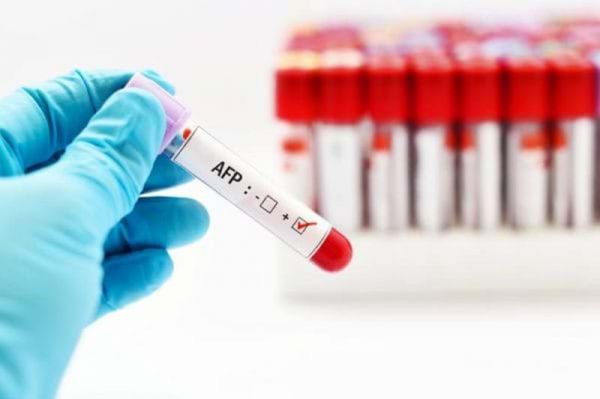 Alpha Fetoprotein (AFP) máu: ý nghĩa lâm sàng kết quả xét nghiệm