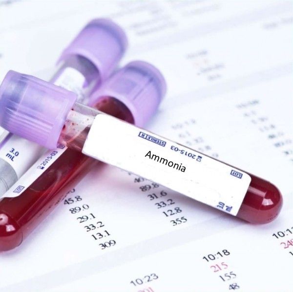 Ammoniac máu: ý nghĩa lâm sàng chỉ số xét nghiệm