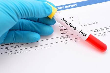 Amylase máu và nước tiểu: ý nghĩa lâm sàng chỉ số xét nghiệm