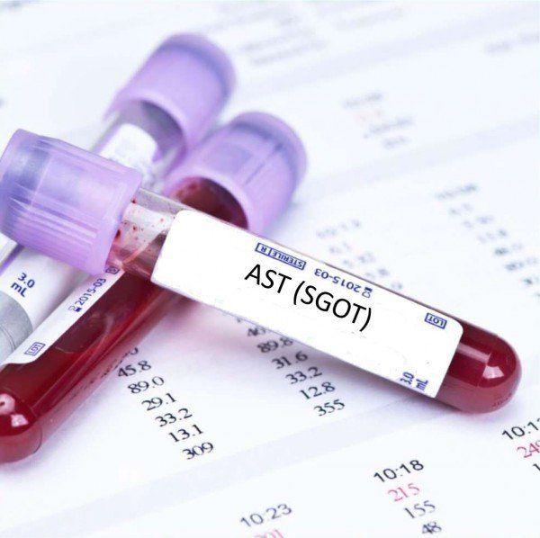 Aspartate Aminotransferase (AST): ý nghĩa lâm sàng chỉ số xét nghiệm men gan