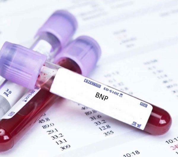 Brain Natriuretic Peptide (BNP): ý nghĩa lâm sàng chỉ số xét nghiệm