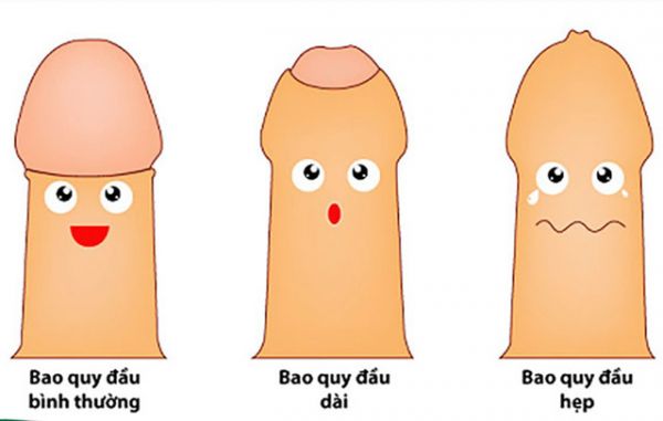 Cắt bao quy đầu