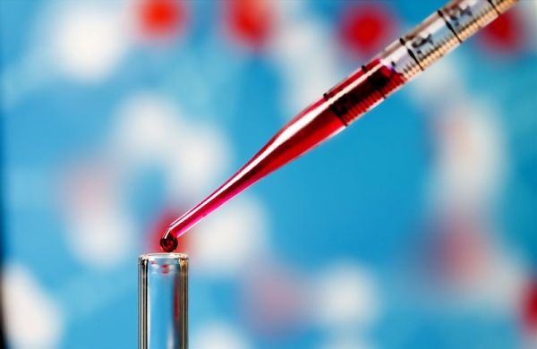 Cấy máu: ý nghĩa lâm sàng kết quả xét nghiệm