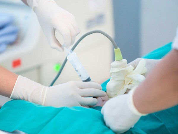 Chọc ối: chỉ định và ý nghĩa lâm sàng