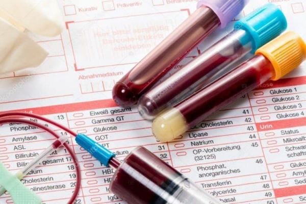 Cholesterol máu: ý nghĩa lâm sàng chỉ số xét nghiệm mỡ máu