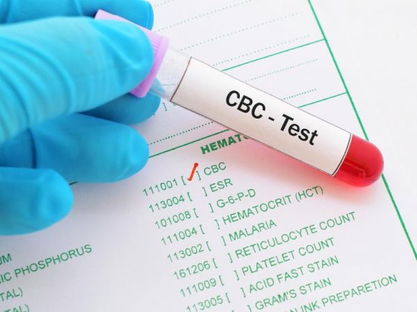 Công thức máu toàn bộ (CBC): ý nghĩa lâm sàng kết quả xét nghiệm
