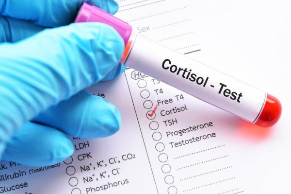 Cortisol trong máu: ý nghĩa lâm sàng kết quả xét nghiệm