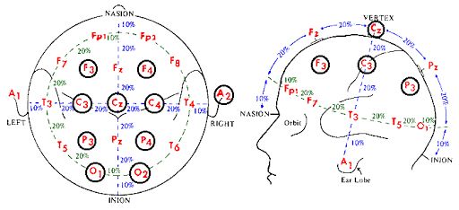 Điện não đồ (electroencephalogram, EEG)