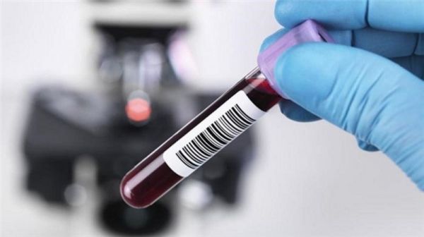 Đo nồng độ cồn trong máu: ý nghĩa lâm sàng chỉ số xét nghiệm