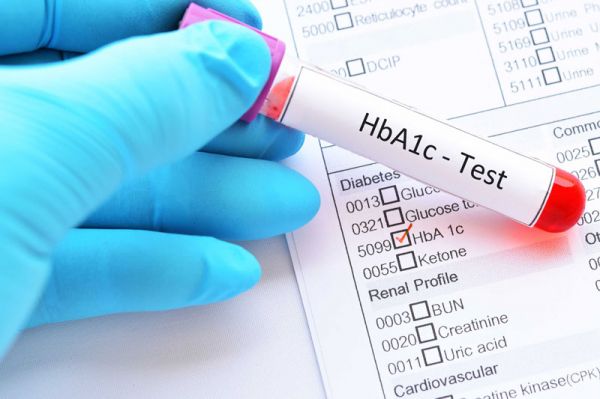 Glycohemoglobin (HbA1c, A1c): ý nghĩa lâm sàng kết quả xét nghiệm