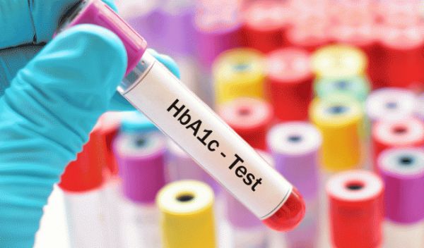 Hemoglobin (Hb): ý nghĩa lâm sàng chỉ số xét nghiệm