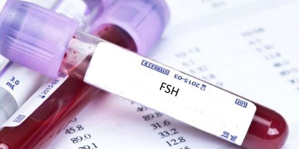 Hormon kích thích tạo nang trứng (FSH): ý nghĩa lâm sàng chỉ số xét nghiệm