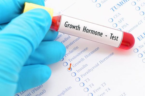 Hormon tăng trưởng (GH): ý nghĩa lâm sàng chỉ số xét nghiệm