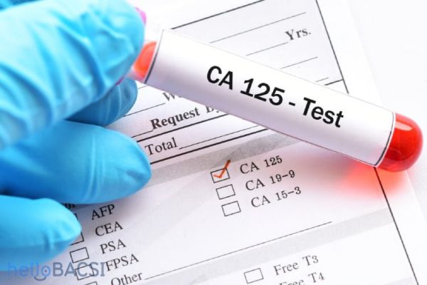 Kháng nguyên ung thư 125 (CA 125): ý nghĩa lâm sàng kết quả xét nghiệm