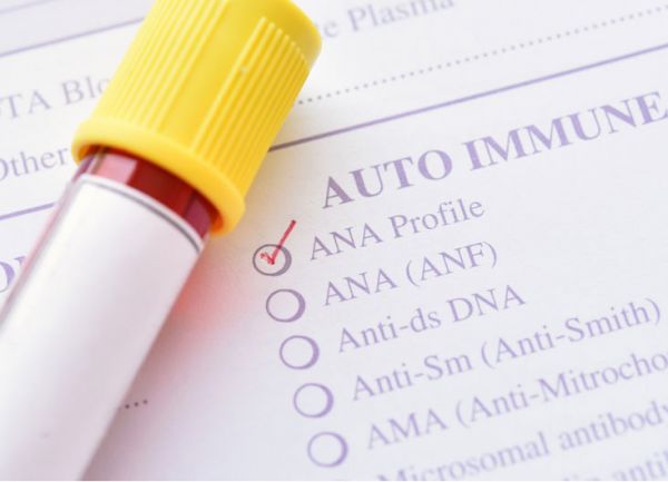 Kháng thể kháng nhân (ANA): ý nghĩa lâm sàng chỉ số xét nghiệm