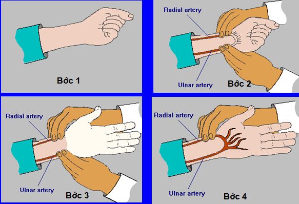 Khí máu động mạch: ý nghĩa lâm sàng chỉ số xét nghiệm