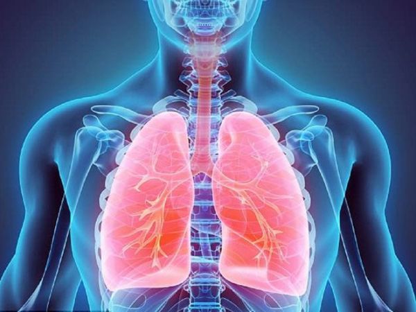 Nhiễm khuẩn gây viêm phổi thùy trên XQ và CT