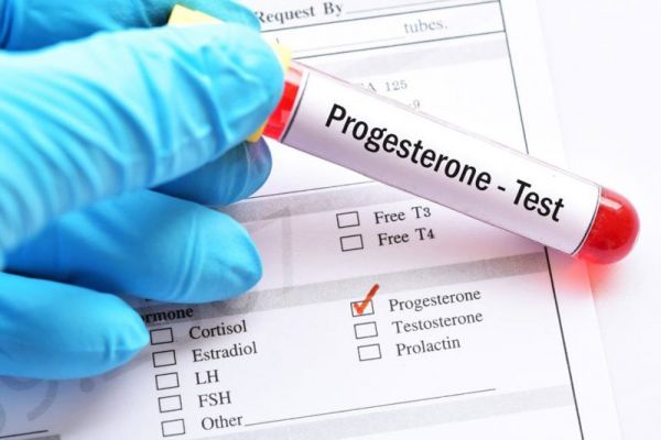 Progesterone: ý nghĩa lâm sàng kết quả xét nghiệm