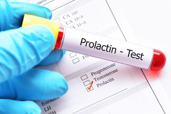 Prolactin: ý nghĩa lâm sàng kết quả xét nghiệm