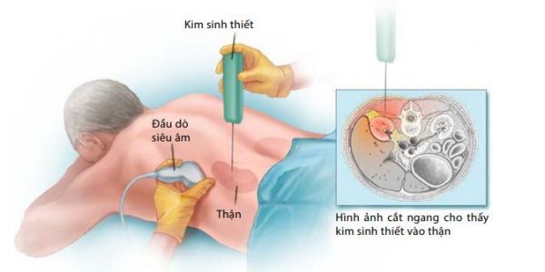 Sinh thiết da