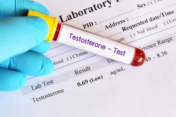 Testosterone: ý nghĩa lâm sàng kết quả xét nghiệm