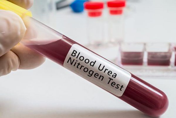 Urê nitơ máu: ý nghĩa lâm sàng chỉ số xét nghiệm