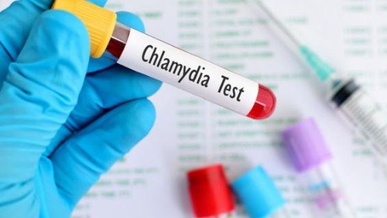 Xét nghiệm Chlamydia: ý nghĩa lâm sàng kết quả xét nghiệm