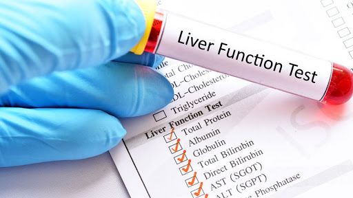Xét nghiệm chức năng gan: đánh giá bệnh gan hoặc tình trạng sản xuất protein