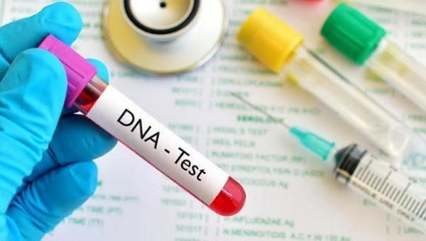 Xét nghiệm di truyền: ý nghĩa lâm sàng kết quả xét nghiệm