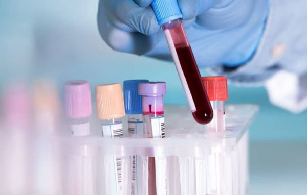 Xét nghiệm đường máu tại nhà: ý nghĩa lâm sàng kết quả xét nghiệm