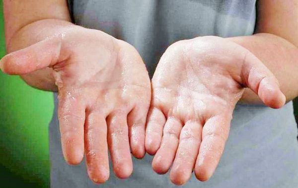 Xét nghiệm mồ hôi: ý nghĩa lâm sàng chỉ số xét nghiệm