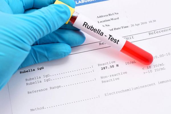 Xét nghiệm Rubella: ý nghĩa lâm sàng chỉ số xét nghiệm