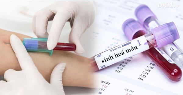 Xét nghiệm sinh hóa máu: ý nghĩa lâm sàng chỉ định xét nghiệm