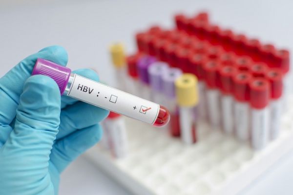 Xét nghiệm virus viêm gan B: ý nghĩa lâm sàng giá trị kết quả