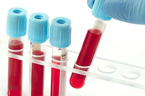 Ý nghĩa lâm sàng chỉ số xét nghiệm huyết học (máu)