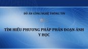 Đồ án: Tìm hiểu phương pháp phân đoạn ảnh y học