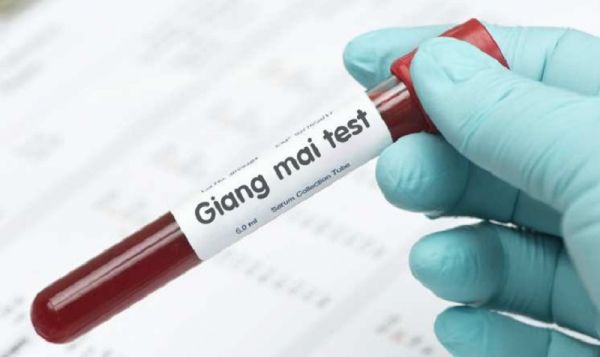 Xét nghiệm giang mai: ý nghĩa lâm sàng kết quả xét nghiệm