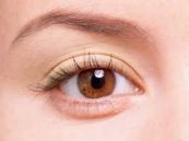 Bệnh bỏng giác mạc do tia cực tím - triệu chứng, nguyên nhân và cách điều trị