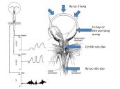 Xét nghiệm niệu động học: ý nghĩa lâm sàng kết quả xét nghiệm