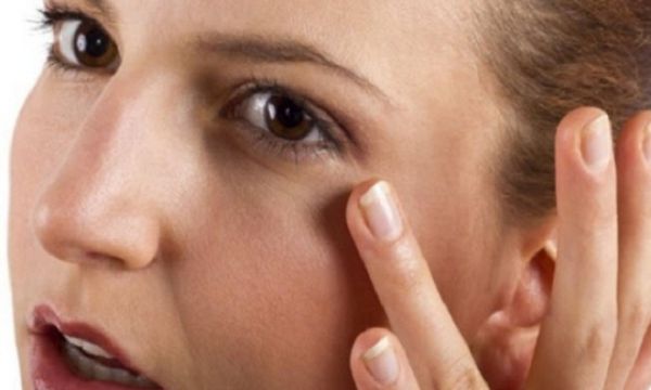 Bệnh bầm tím mắt - Triệu chứng, nguyên nhân và cách điều trị